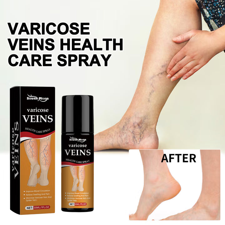 Vein Healing Varicose Veins Treatment Spray 50ml (Pack Of 2)
